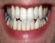 تطبيق جديد يتيح لأطباء الأسنان علاج المرضى بمكالمة فيديو